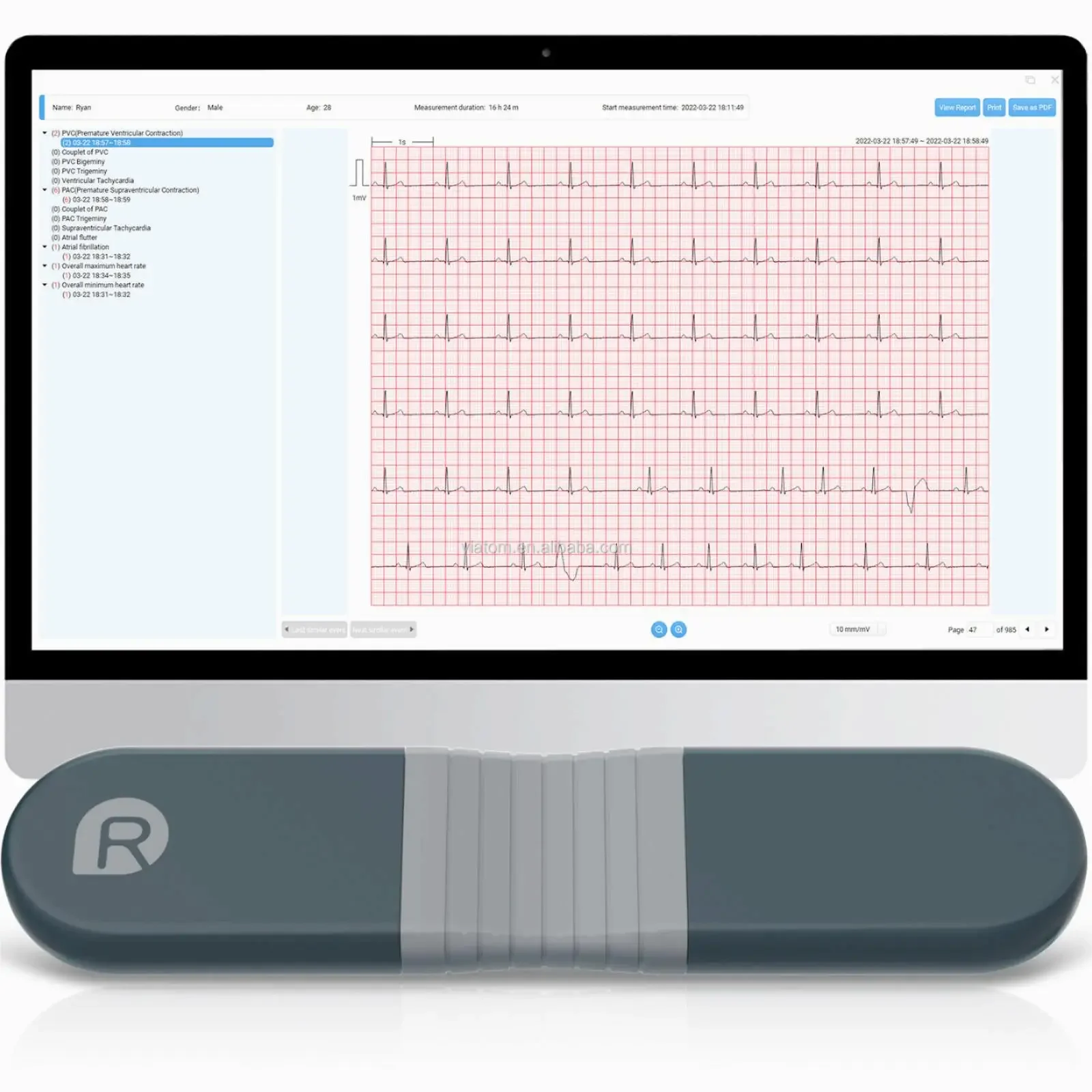 Enregistreur dynamique Bluetoo - Ecg Patch Monitor avis et prix